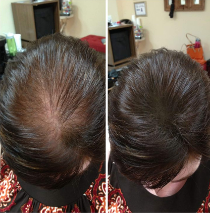 HairGlow™ Suplemento Capilar De Crecimiento Intensivo Pro-Biotina
