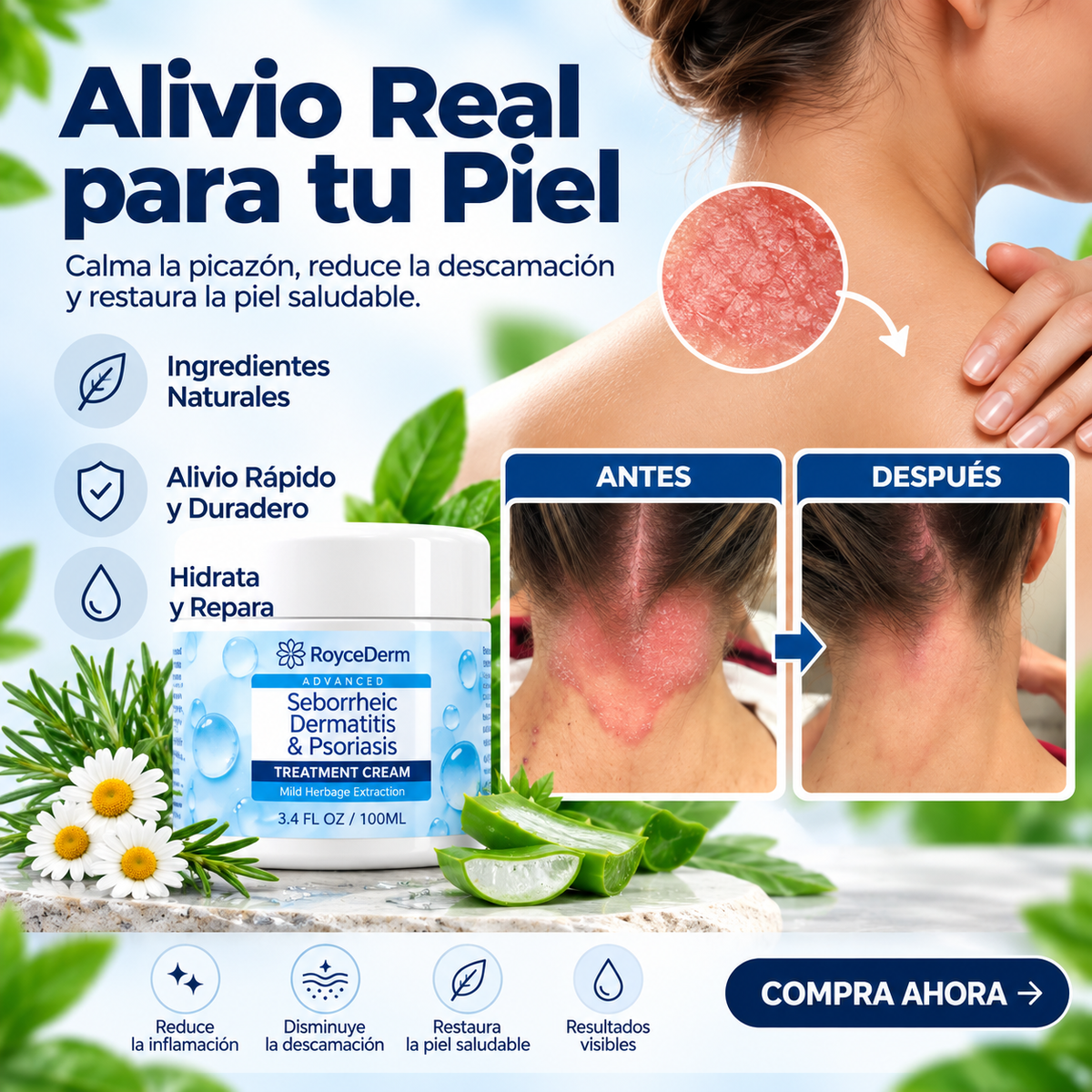 Roycederm® - Crema Reparadora para Dermatitis