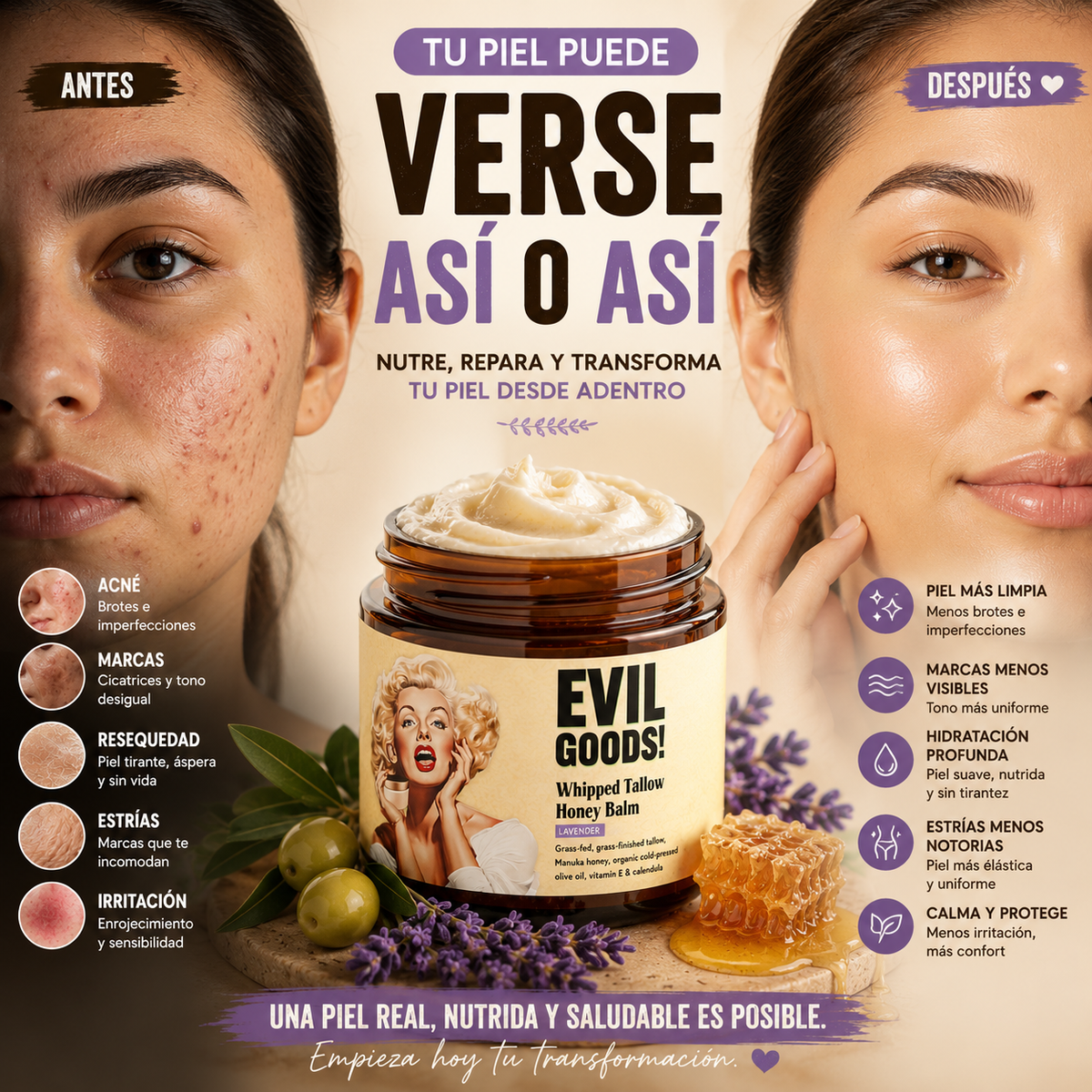 Crema Hidratante Natural EVIL GOODS | Adiós Acné y Piel Seca