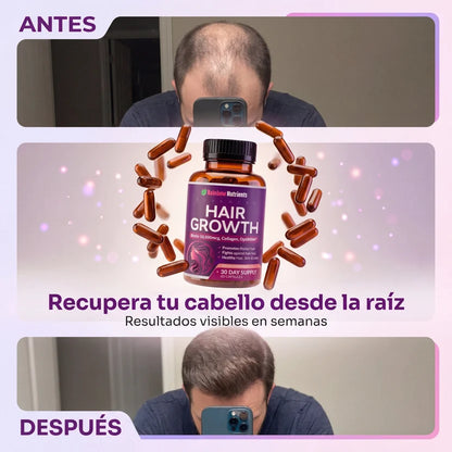HairGlow™ Suplemento Capilar De Crecimiento Intensivo Pro-Biotina