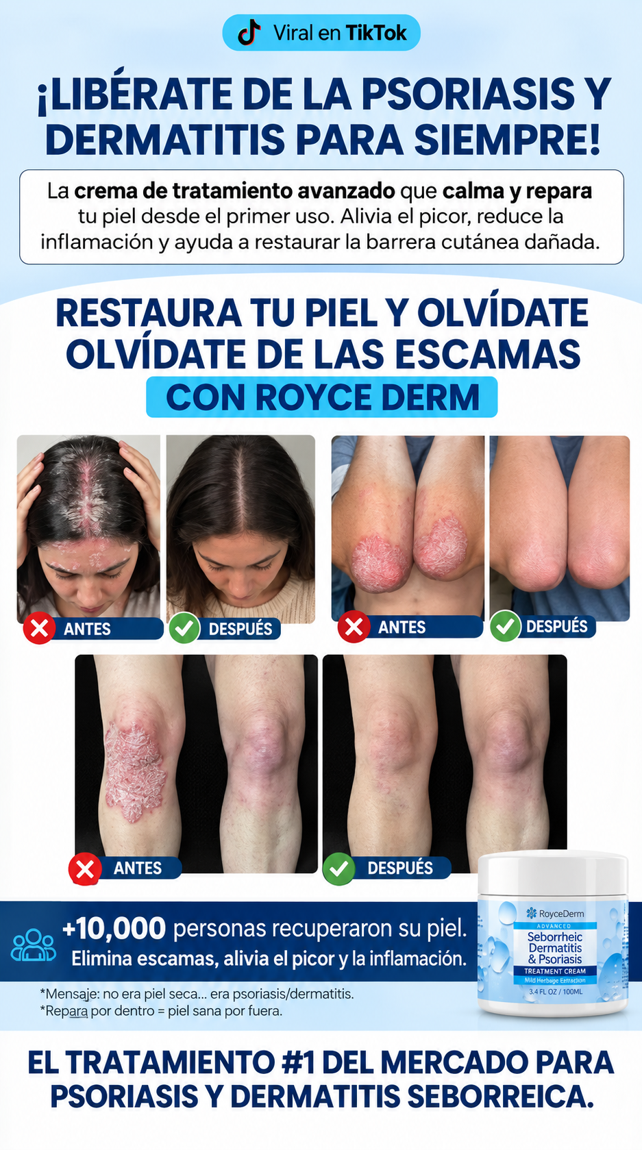 Roycederm® - Crema Reparadora para Dermatitis