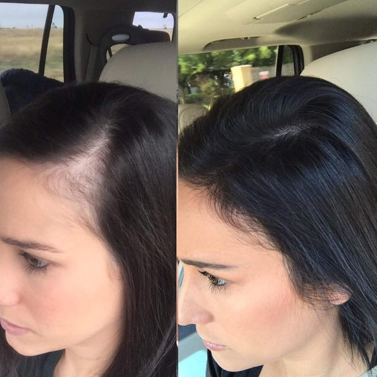 HairGlow™ Suplemento Capilar De Crecimiento Intensivo Pro-Biotina